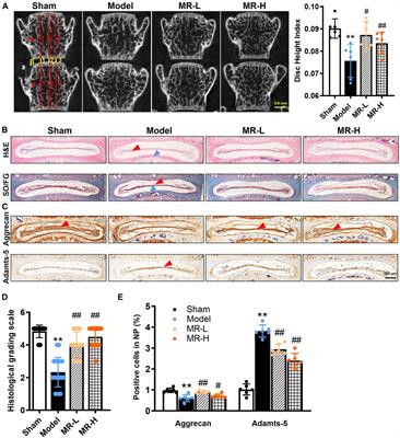 Morroniside attenuates nucleus pulposus cell senescence to alleviate intervertebral disc degeneration via inhibiting ROS-Hippo-p53 pathway